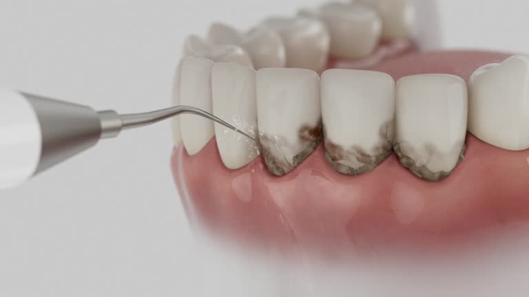 Trusted Dental Implants service in Conyngham, PA - Dentist Open Now